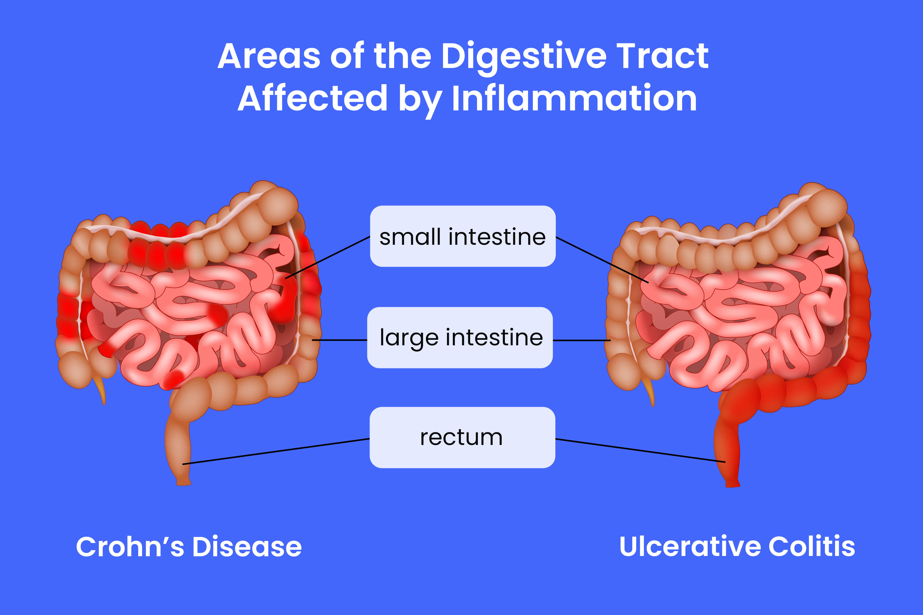 Best Gastroenterologist in Bathinda