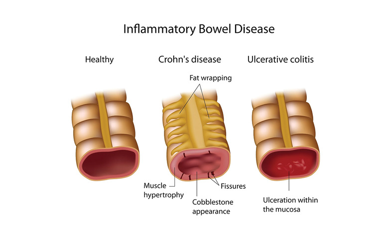 Best Gastroenterologist in Bathinda