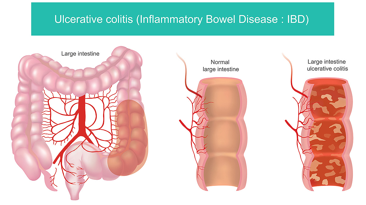 Best Gastroenterologist in Bathinda