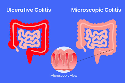 Best Gastroenterologist in Bathinda